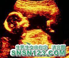怀孕130天宝宝发育图