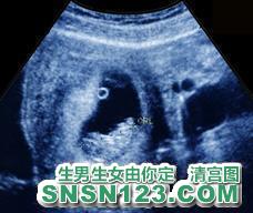 怀孕79天宝宝发育图