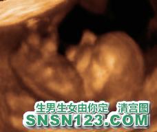 怀孕78天宝宝发育图