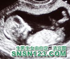 怀孕91天宝宝发育图