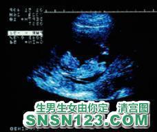 怀孕73天宝宝发育图