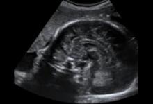 怀孕146天